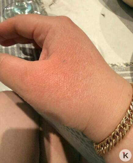 «Я только кричала: мама, отбегай!»: в Чкаловске подросток распылил перцовый баллончик в лицо двум женщинам   - Новости Калининграда | Фото: Наталья