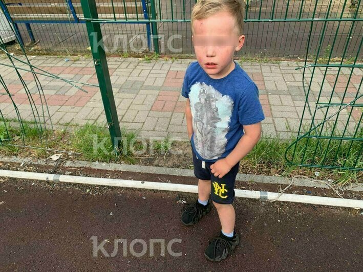 Пострадавший ребёнок в июне 2024 года | Фото: Татьяна Завьялова