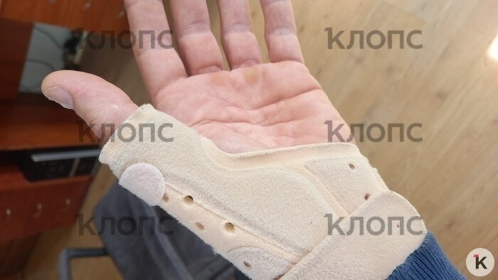 У мужчины после избиения травма запястья  | Фото: предоставил Евгений 