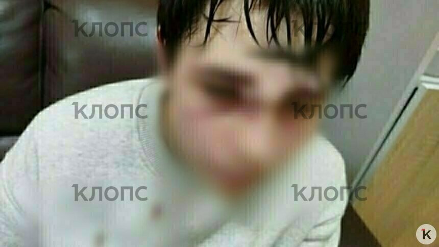 Никиту избили в школе 15 апреля  | Фото: предоставила Татьяна 