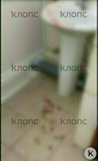 Туалет был залит кровью, у подростка перелом носа со смещением и руки  | Фото: предоставила Татьяна 