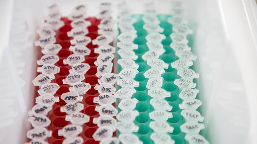 Заболеваемость ВИЧ в России с 2016 года сократилась вдвое - Новости Калининграда | Фото: Александр Подгорчук / Архив «Клопс»