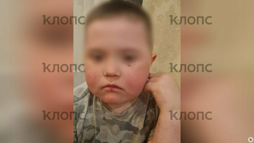 На момент происшествия мальчику было семь лет | Фото: предоставила мама ребёнка
