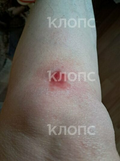 Смерть в последний день весны и травмы из-за разбитой плитки в Калининграде: 8 событий, которые обсуждали в выходные   - Новости Калининграда | Фото: Елена