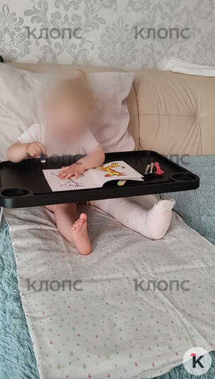 После случившегося ребёнок не может привыкнуть к гипсу, малышку постоянно приходится развлекать | Фото: предоставила мама девочки 