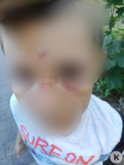 «Он прописал мне лоу-кик»: в Васильково женщина ударила восьмилетнего мальчика после ссоры детей (фото) - Новости Калининграда | Фото: предоставила Марина