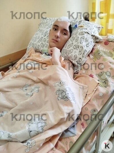 В РДКБ подростку могут восстановить череп, там же он пройдёт реабилитацию  | Фото: предоставила мама Фёдора