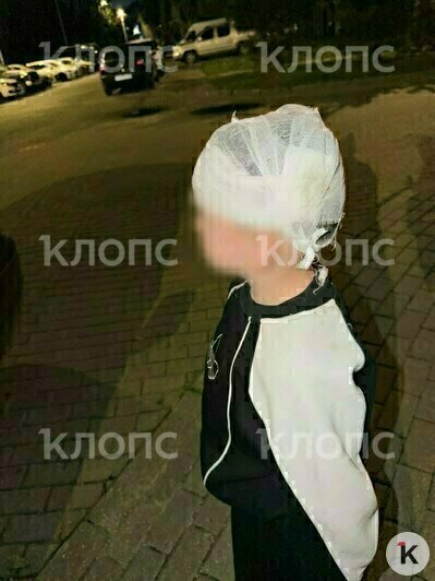 Мальчик попал в больницу, а кидавшие камни дети, оглядываясь, скрылись на велосипедах | Фото: предоставила мама Дениса 