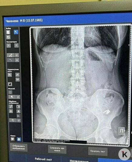 На первом снимке наушник левее: в кадр кроме него случайно попало украшение на теле | Фото: Мария