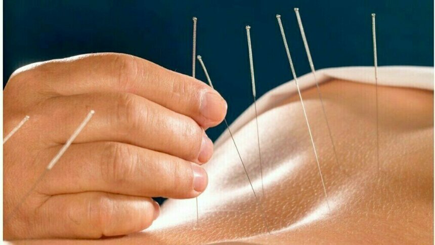 Жизнь без боли: колоссальный опыт устранения причины боли при помощи восточной медицины - Новости Калининграда