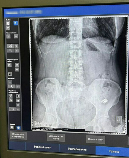 На первом снимке наушник левее: в кадр кроме него случайно попало украшение на теле | Фото: Мария