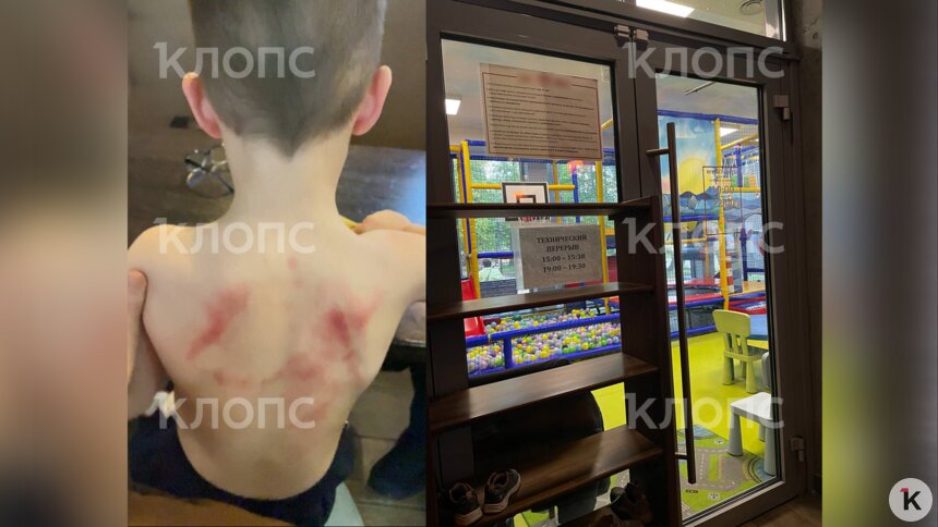 Мальчик пострадал в игровой комнате кафе | Фото: предоставила Наталья 