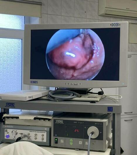 В Калининграде врачи областной больницы начали удалять опухоли кишечника без разрезов - Новости Калининграда | Фото: канал министерства здравоохранения Калининградской области / Телеграм