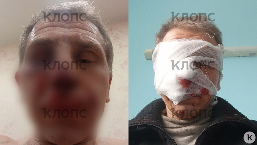 У мужчины множественные рваные раны лица и руки | Фото: предоставил Александр 