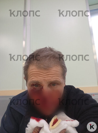 Калининградец проходит лечение в больнице | Фото: предоставил Александр 