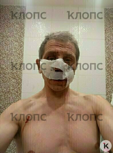 Калининградец проходит лечение в больнице | Фото: предоставил Александр 