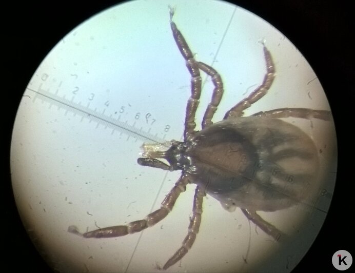 Нимфа в поле зрения бинокулярного микроскопа | Фото: Евгений Волчев