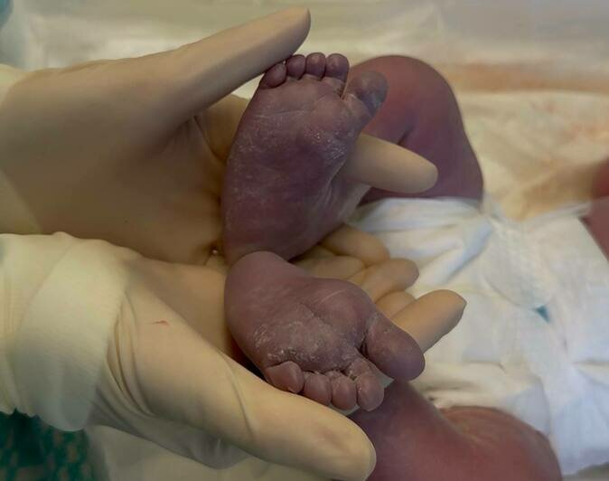 В перинатальном центре Калининграда женщина родила седьмого ребёнка после шести кесаревых - Новости Калининграда | Фото: канал министерства здравоохранения Калининградской области / Телеграм